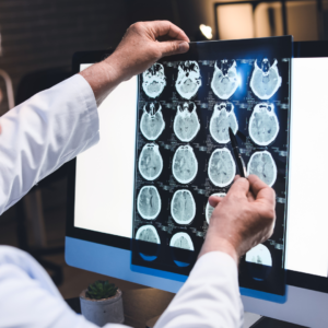 A medical professional in a white coat holds up a sheet of brain scan images against a lighted screen, pointing to one of the scans with a pen, suggesting a close review of brain imaging results.